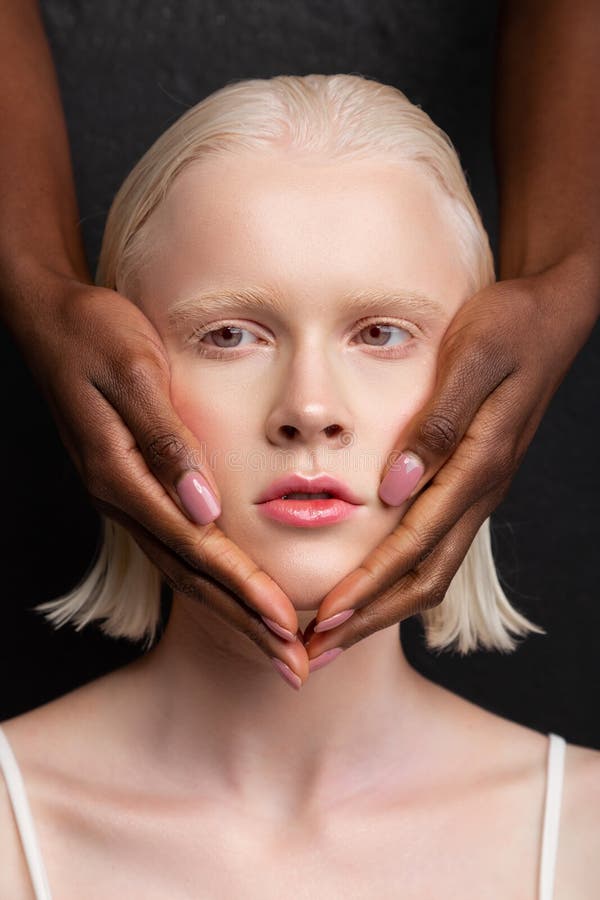 Woman With Short Bob Cut Having Dark-Skinned Hands On Face Stock Image -  Image Of Diversity, Albino: 144725533