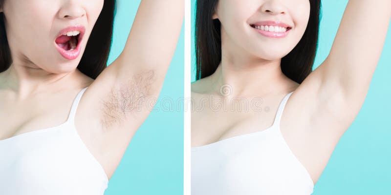 Beauty woman take picture with under armpit problem before and after stock ...
