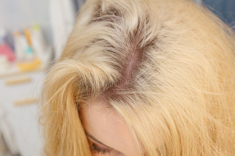 8. How to Prevent Blonde Roots from Showing - wide 7