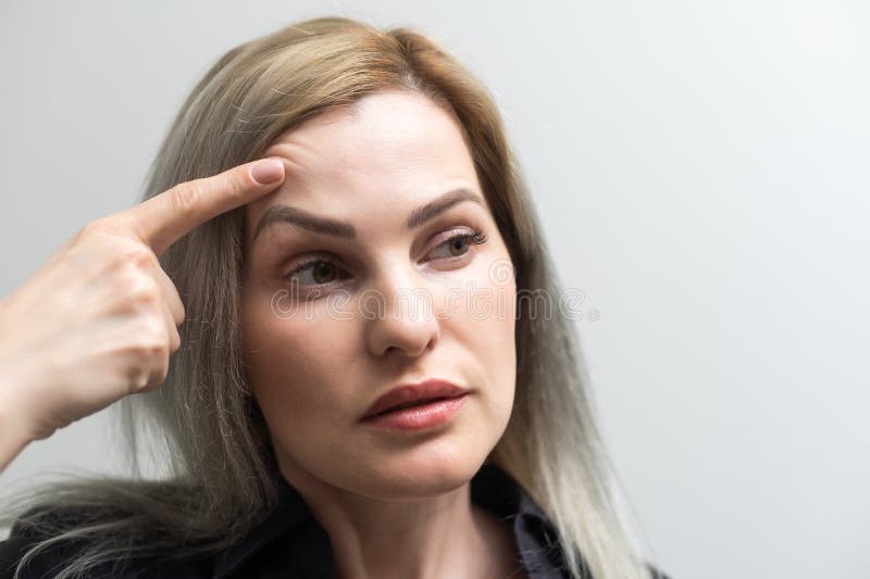 Woman Shows Drooping Eyelid for Plastic Surgery Stock Photo Image of