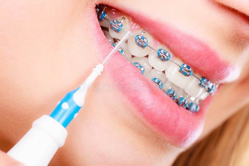 Woman smiling cleaning teeth with braces