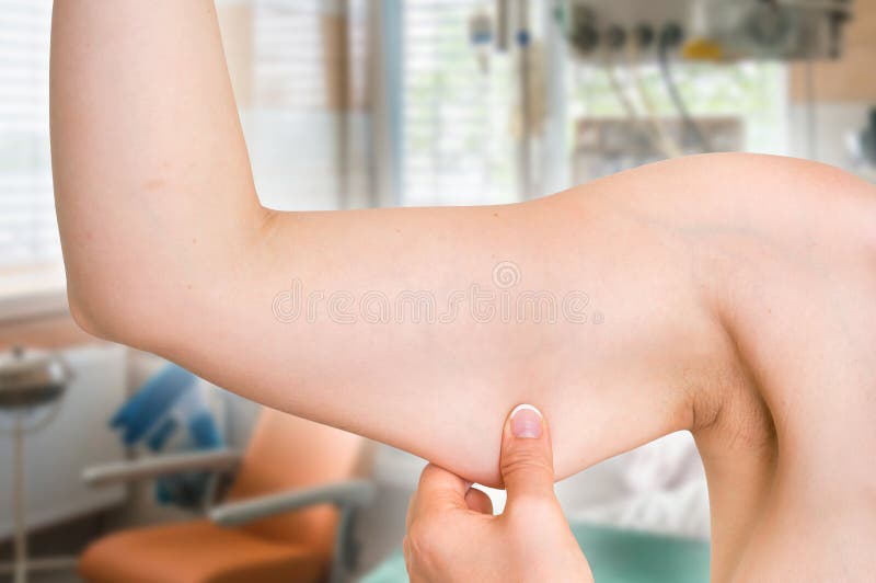 Woman is testing her muscle under her arm - cosmetic surgery concept