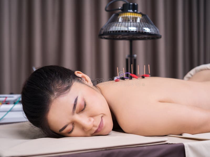 Woman undergoing acupuncture treatment with electrical stimulator on back royalty free stock images Woman undergoing acupuncture treatment with electrical stimulator on back royalty free stock images
