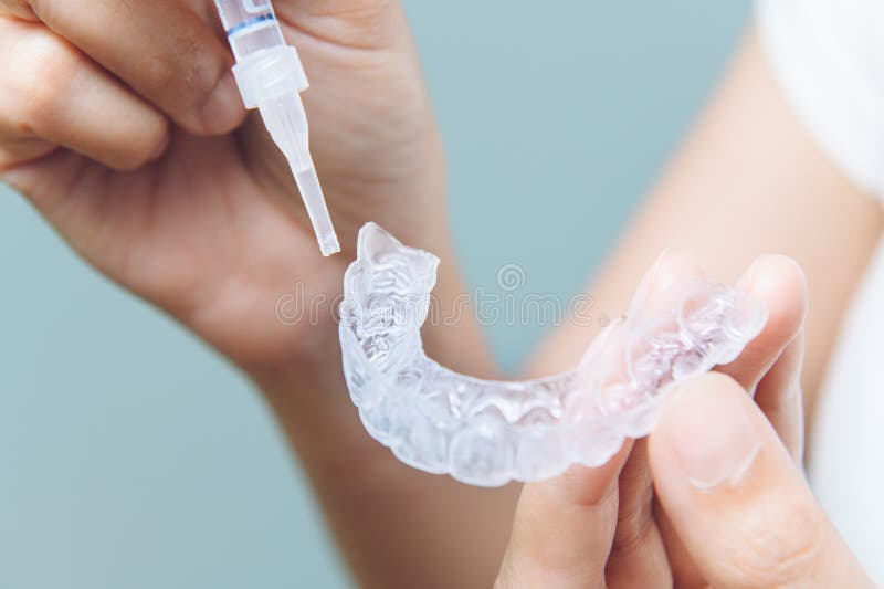 Tooth whitening gel being applied to a tooth mold in preparation for being placed in the mouth. Tooth whitening gel being applied to a tooth mold in preparation for being placed in the mouth.