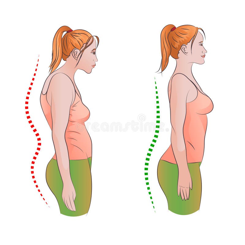 Woman with wrong and right back posture royalty free illustration