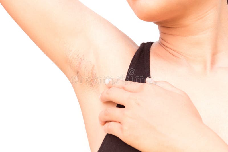 Women problem black armpit on white background for skin care and beauty concept. Problem wrinkle stock images, royalty-free photos and pictures
