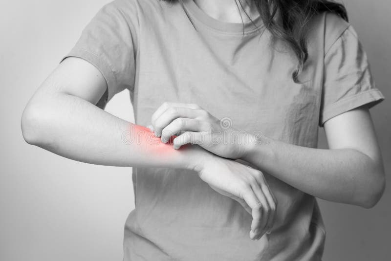 Women scratch itchy arm, Women scratch itchy arm with hand. stock photo Women scratch itchy arm, Women scratch itchy arm with hand. stock photo
