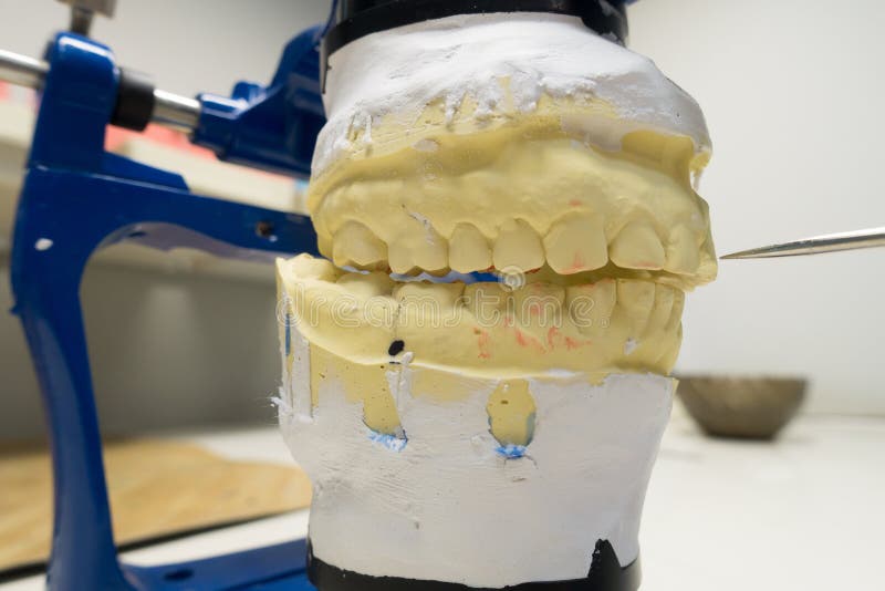 Workplace of a Dental Technician Stock Image Image of implant, dental