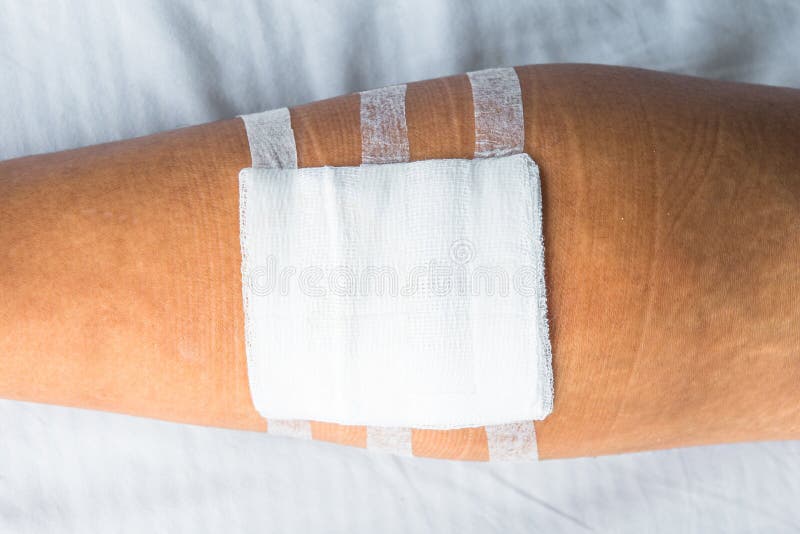 Dressing on leg stock photo. Image of bandage, care, injury 40923366