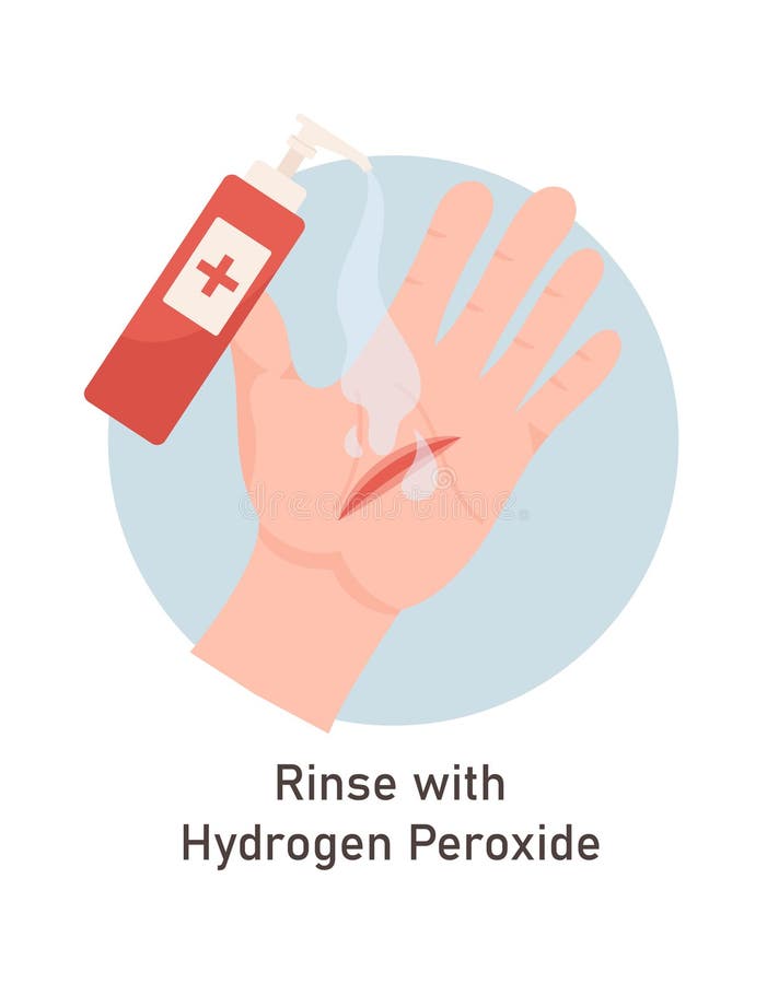 Wounds First Aid with Antiseptic Stock Illustration Illustration of