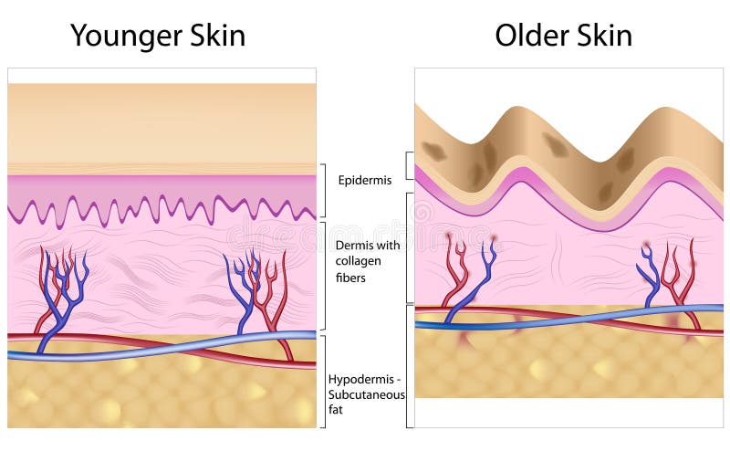 Wrinkled versus smooth skin