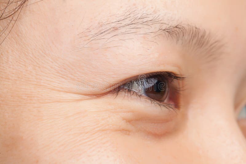 Download Wrinkles stock image. Image of aging, natural, woman - 34588273