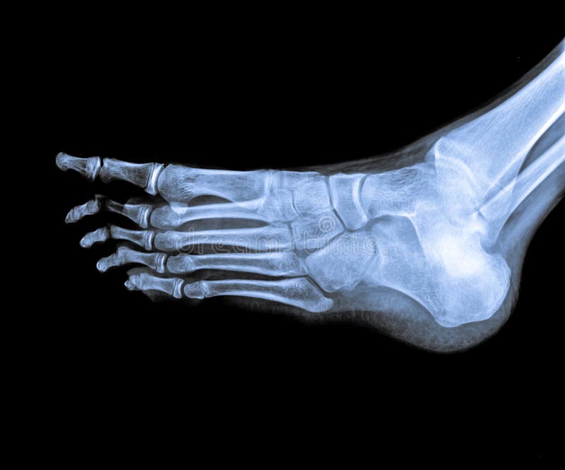 X Ray D'articulation De La Cheville Image stock Image du soin, patte