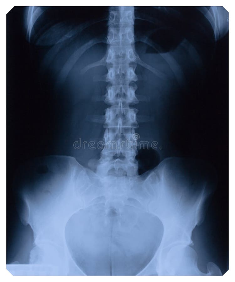 1,461 X Ray Female Body Stock Photos - Free & Royalty-Free Stock Photos  from Dreamstime