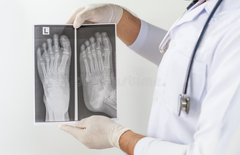 X ray of foot front view, Doctor looking chest x-ray film,Anatomy. stock images X ray of foot front view, Doctor looking chest x-ray film,Anatomy. stock images