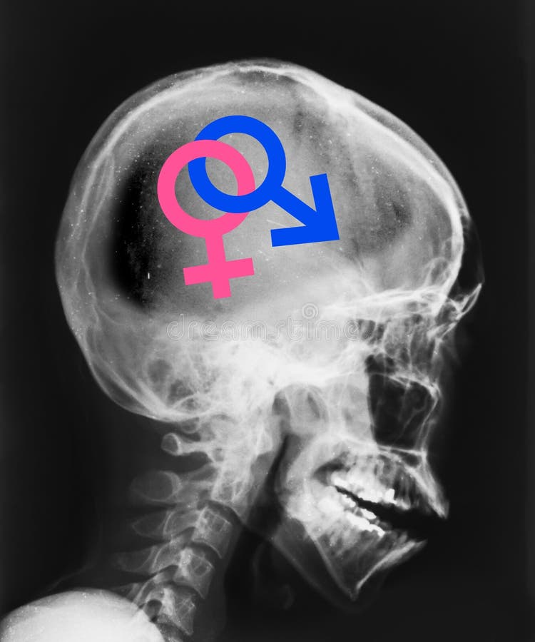 X Ray Of Head Isolated And Symbol Sex Inside Stock Image Image Of