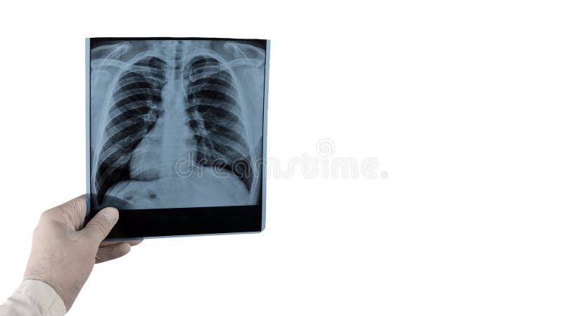 X-ray of human img