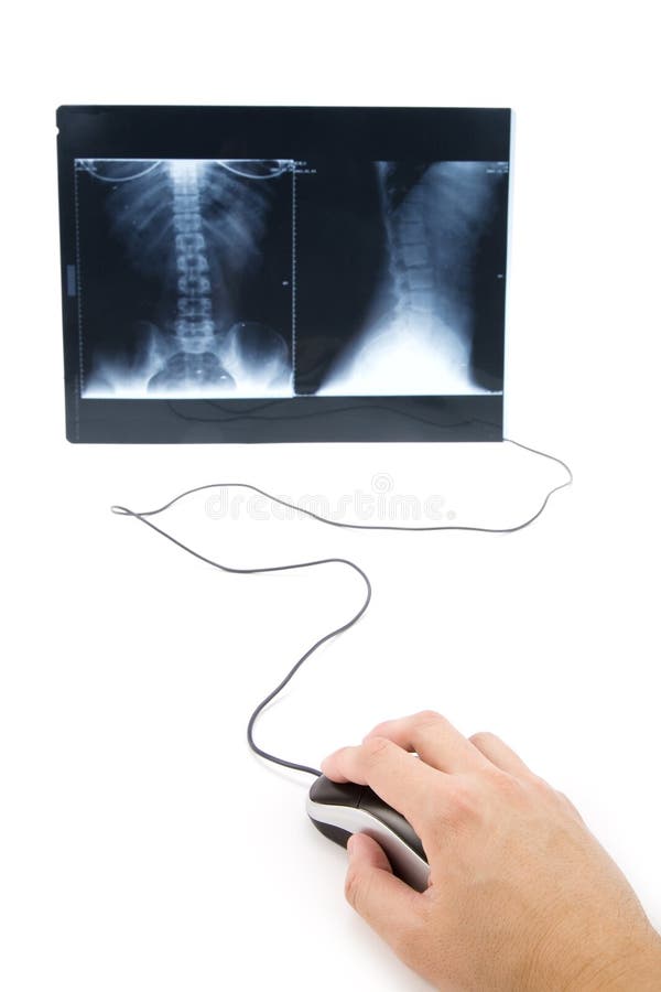 X-ray image and computer mouse stock images