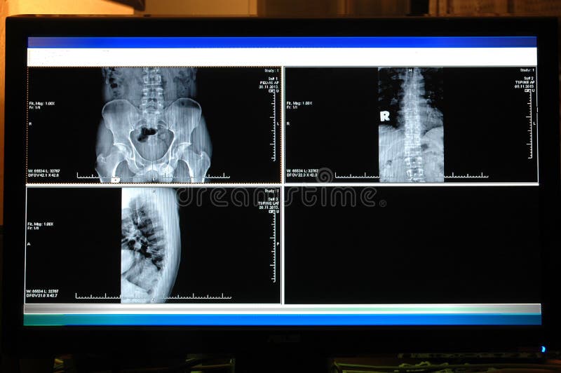 free mckesson viewer download free mckesson viewer download