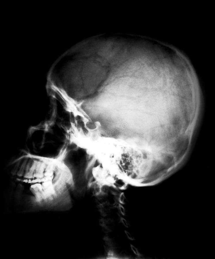 Pin de Celia De Los Reyes en forensics Radiografia de craneo, Actividades del cu