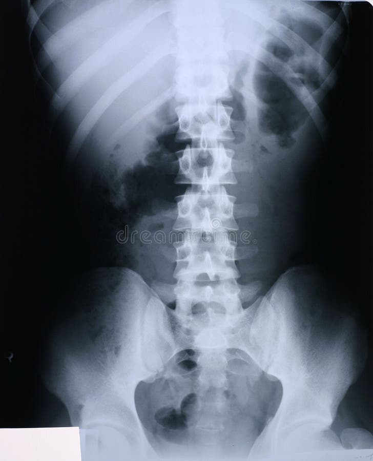 x10 xray vision