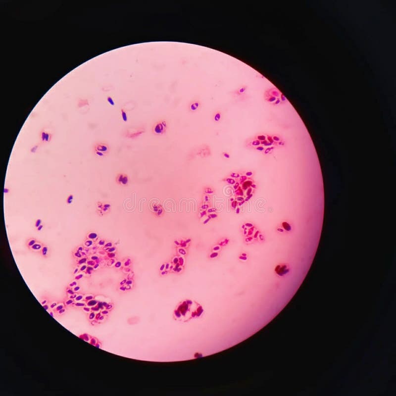 Staphylococcus Aureus Gram Stain Stock Photos Free & RoyaltyFree