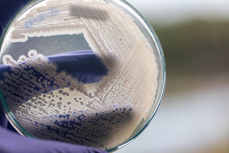 Yeast in Petri Dish for Education in Laboratories. Stock Photo Image