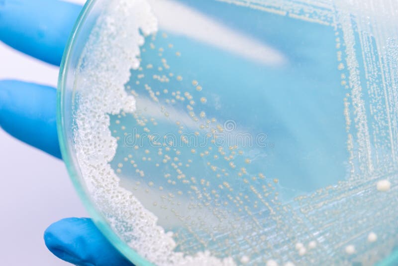 Yeast in Petri Dish, Microbiology for Education. Stock Photo Image of