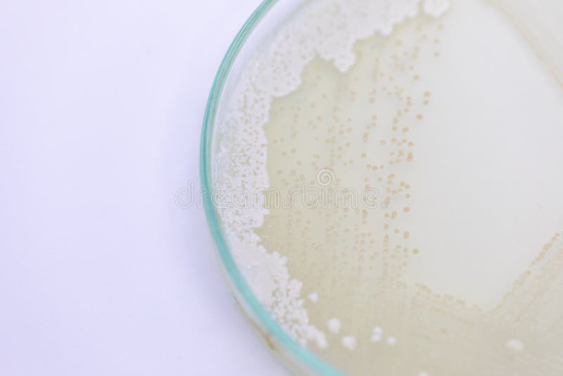 Yeast in Petri Dish, Microbiology for Education. Stock Image Image of