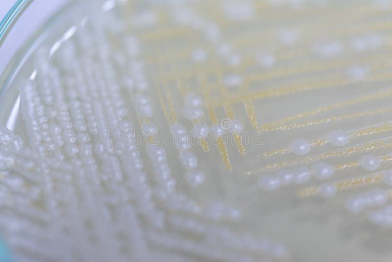 Yeast in Petri Dish, Microbiology for Education. Stock Photo Image of