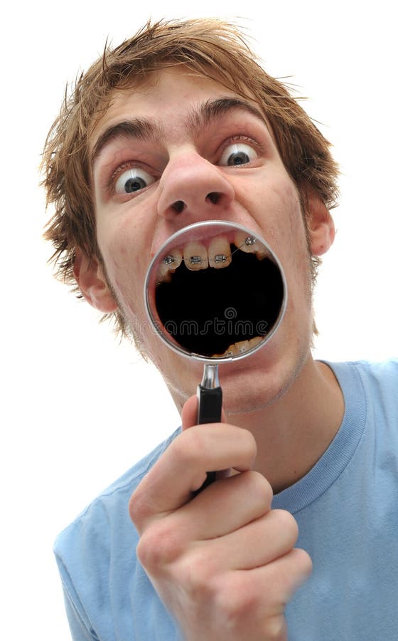Young adult man holding magnifying glass to mouth, he has braces and his mouth is black inside.