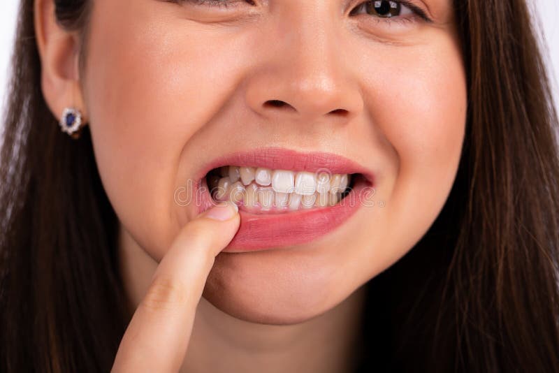 Young beautiful woman touches her teeth with her finger on the lower jaw, showing a problem with teeth or gums