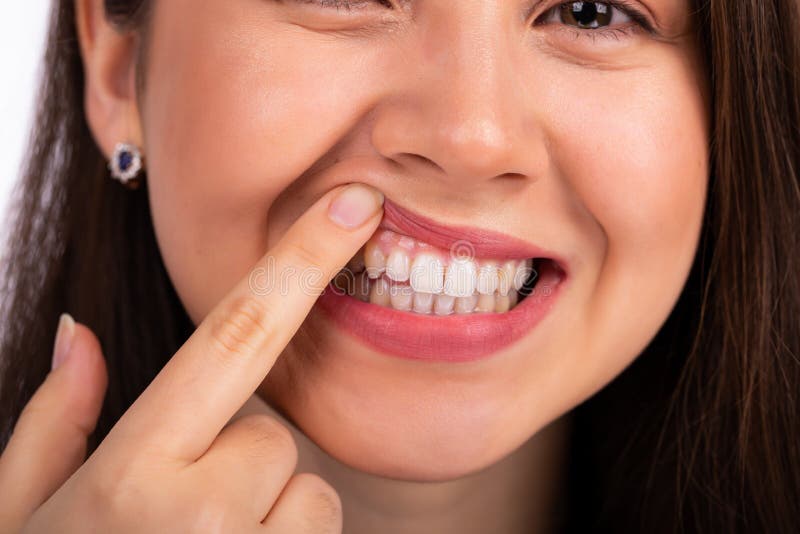 Young beautiful woman touches her teeth on the upper jaw with her finger, showing a problem with the teeth or gums