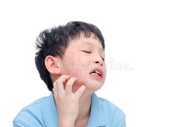 Young boy scratching his face royalty free stock image Young boy scratching his face royalty free stock image