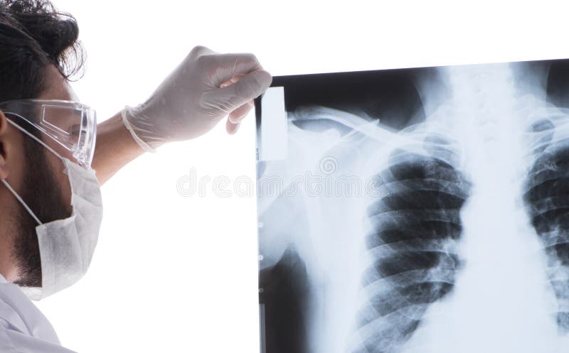 Young doctor looking at x-ray images isolated on white royalty free stock images Young doctor looking at x-ray images isolated on white royalty free stock images