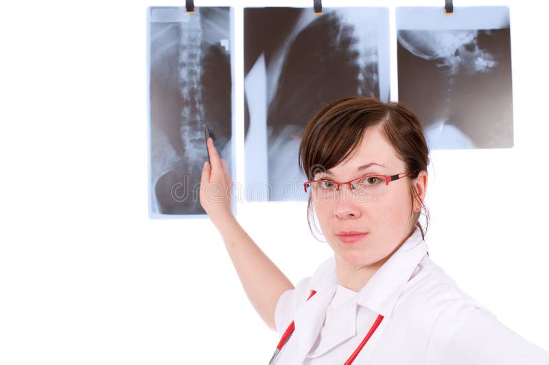 Young female doc pointing on x-ray, isolated