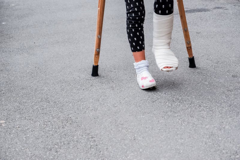 Cast leg sexy