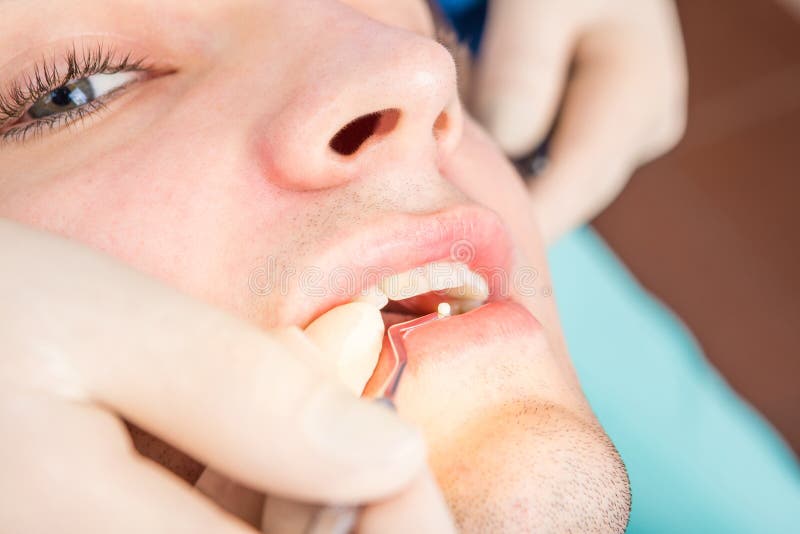 A young guy at a dentist`s reception. stock images A young guy at a dentist`s reception. stock images