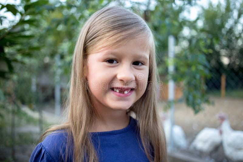 Young little girl without a front tooth