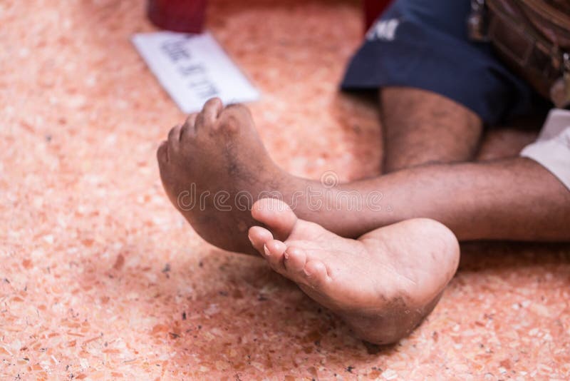 Young Man crippled leg from birth Sit on the floor for begging. stock photo Young Man crippled leg from birth Sit on the floor for begging. stock photo