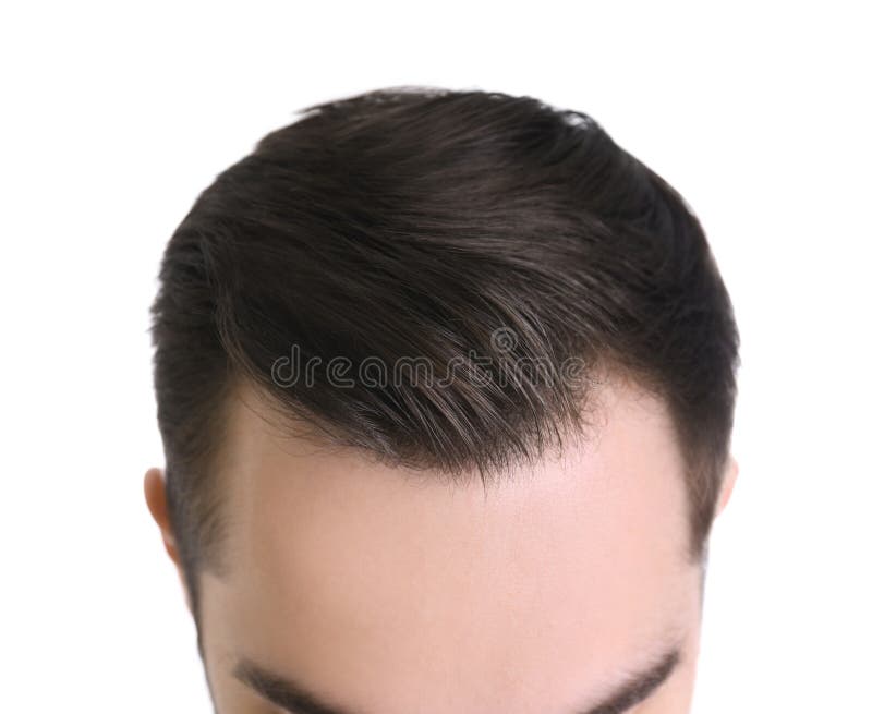 Young Man with Hair Loss Problem on White Background Stock Image - Image of care, regrowth: 145678621 Young Man with Hair Loss Problem on White Background Stock Image - Image of care, regrowth: 145678621