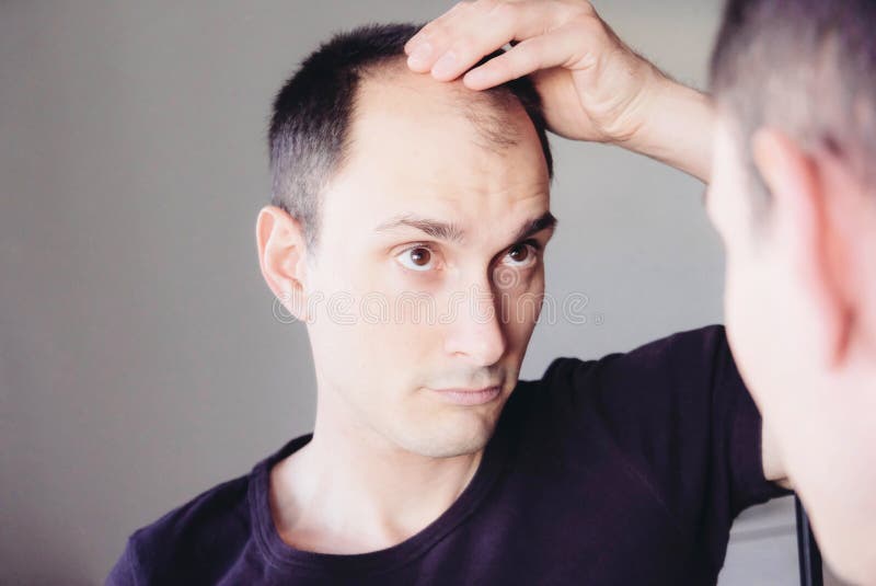 Young Man Looking at Mirror Worry about Balding Stock Photo - Image of  issue, bald: 187139184