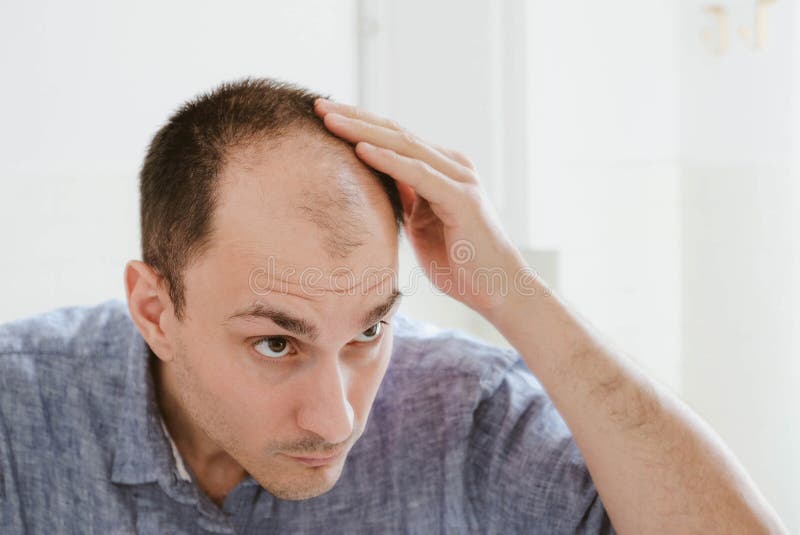 Young man looking at mirror worry about balding