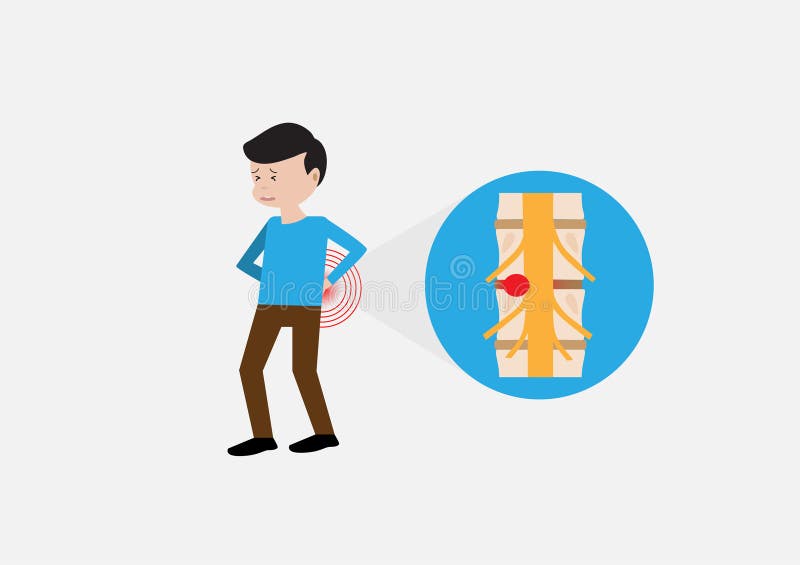 Young Man Suffering from Herniated Disc with Back Pain Stock