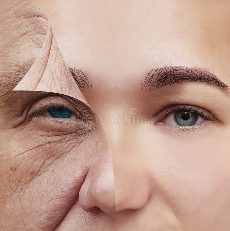 Young and old face before and after concept