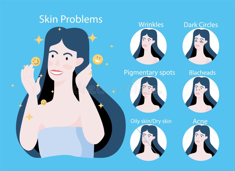 Young woman with bad skin problems. Woman with pimples royalty free illustration