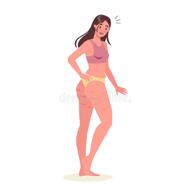 Young woman with cellulite on her thighs. Girl in underwear with skin vector illustration