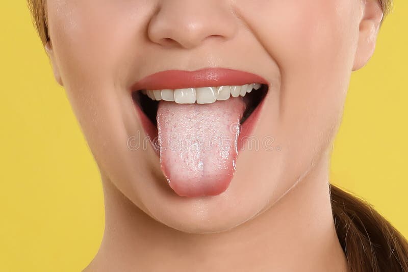 normal tongue coating