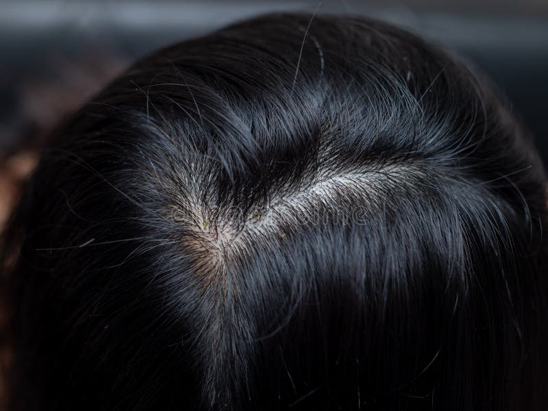 Young woman shows her white hair roots royalty free stock photography