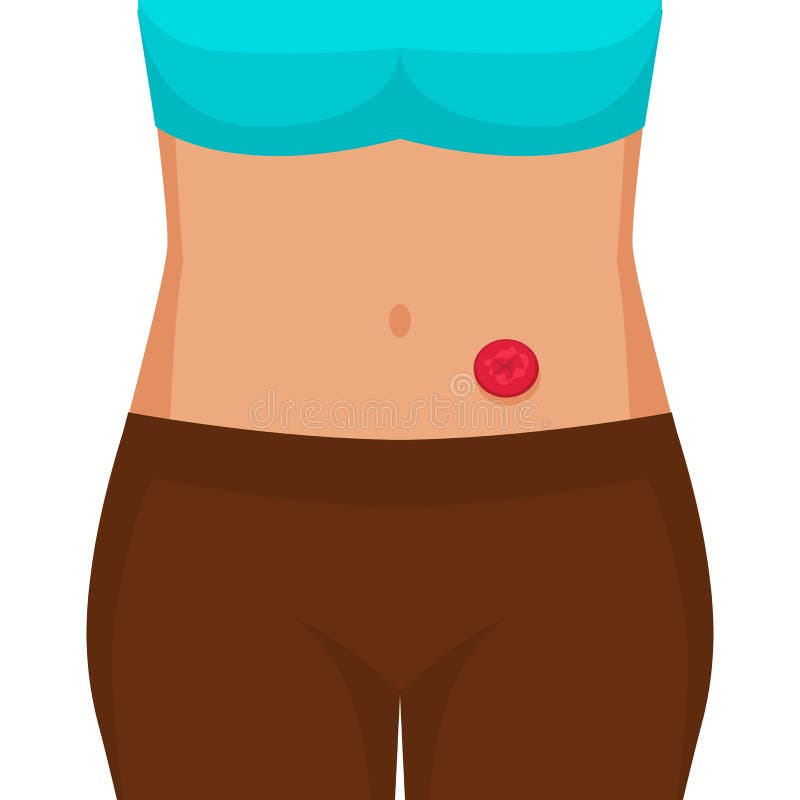 Stoma Stock Illustrations – 261 Stoma Stock Illustrations, Vectors